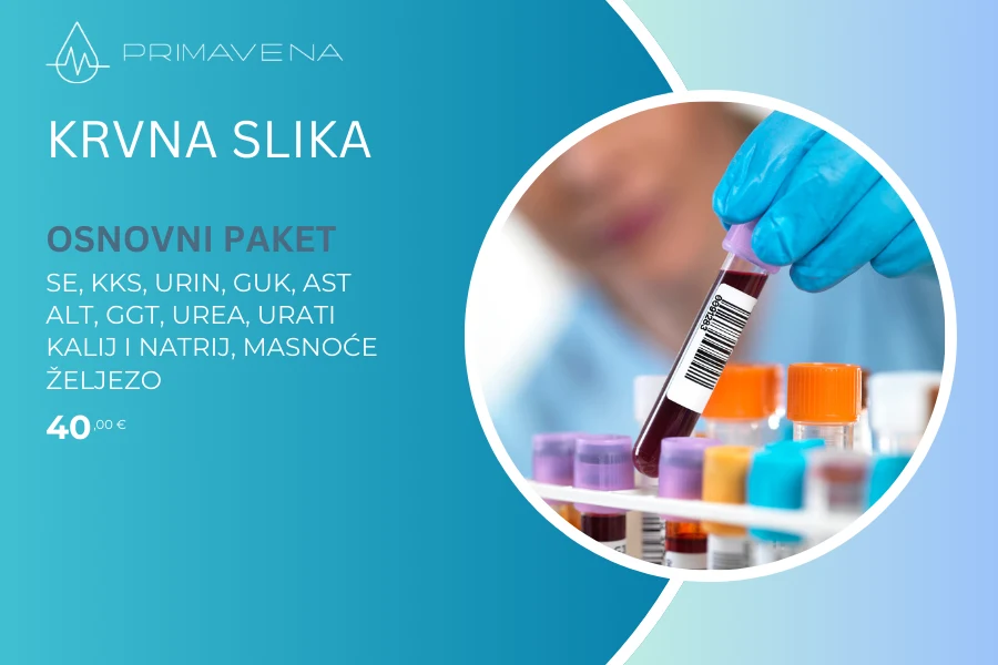 Kompletna krvna slika / Osnovni paket