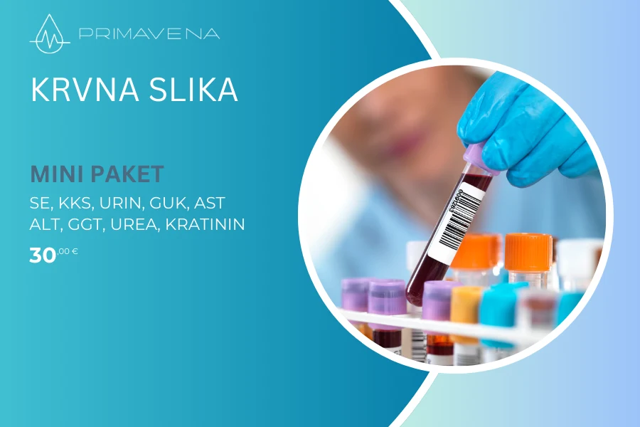 Kompletna krvna slika / Mini paket
