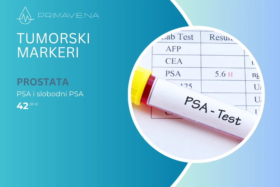 Tumorski markeri / Prostata