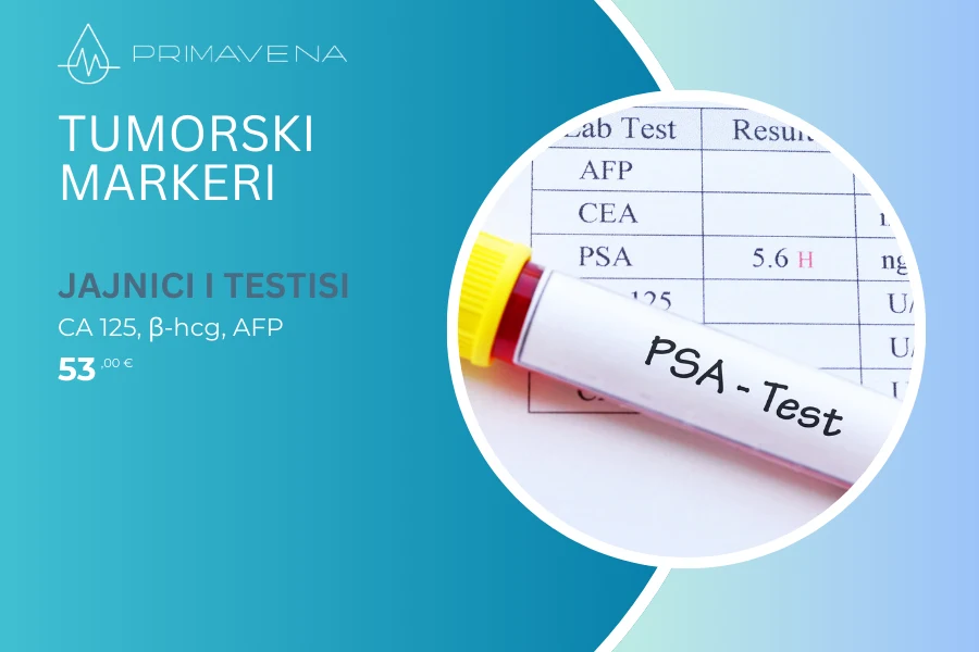 Tumorski markeri / Jajnici ili testisi